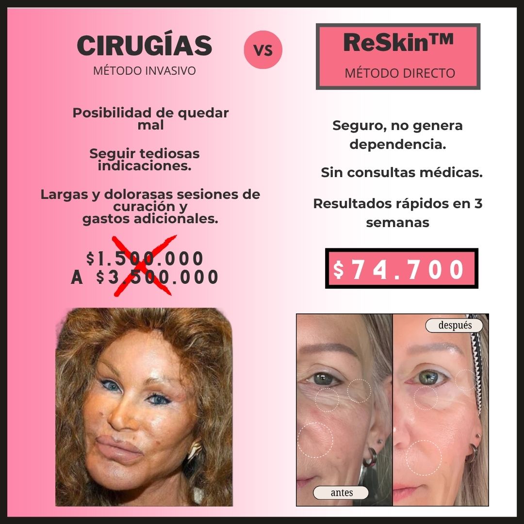 |Cinta de silicona contra arrugas rostro y cuello|  ReSkin™