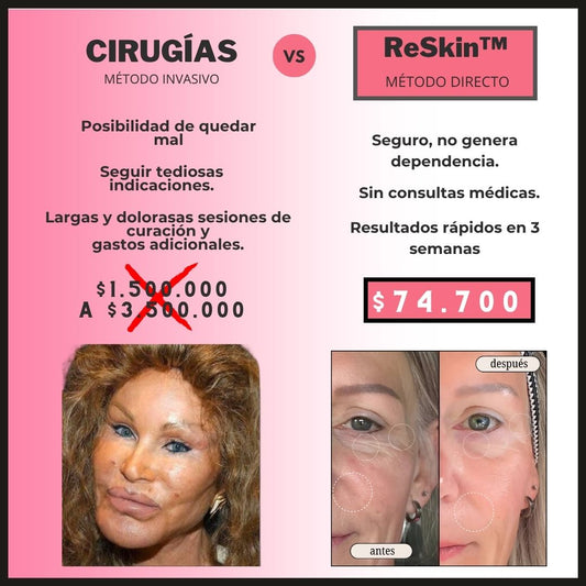 |Cinta de silicona contra arrugas rostro y cuello|  ReSkin™