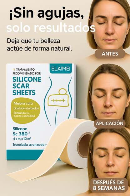 ReSkin™ | Parches de silicona contra arrugas y cicatrices